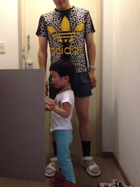 「adidas Originals by JEREMY SCOTT」｜「アイテム（サンダル）」を使った、マーチンさん（メンズ・170cm）の夏コーディネート