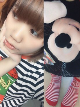 「stripes」｜「アイテム（雑貨/ホビー）」を使った、スキ♡さん（レディース・150cm）の夏コーディネート